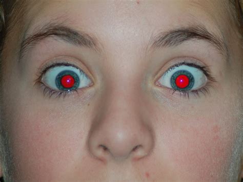 What Causes Red Eyes In Photographs
