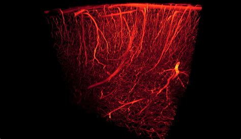 Manufacturing Synthetic Blood Vessels That Grow With The Patient The