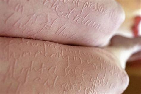 Unexplained Scratches Why People Get Strange Scratches On Their Body