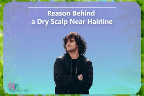 Reason Behind A Dry Scalp Near Hairline A Center For Curly Hair