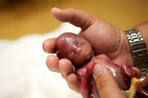 7 Images That Prove The Humanity Of Unborn Babies