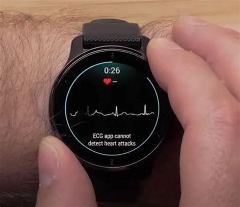 7 Best Smartwatches With Ecg Fda Approved In 2024