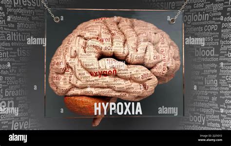 Anatomía De La Hipoxia Sus Causas Y Efectos Proyectados En Un Cerebro