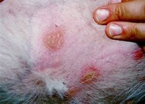 Mrsa Staph Infection Symptoms And Treatment