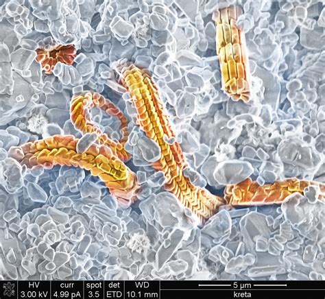 One of the latest discoveries made about using an electron microscope is the ability to identify a virus. Dual Beam Scanning Electron Microscope (SEM/FIB)
