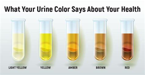 The Color Of Your Urine Tells A Lot About Your Health Small Joys