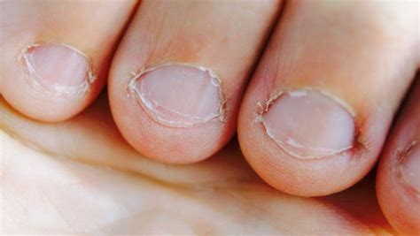 Researchers Explain What Biting Your Nails Says About Your Personality