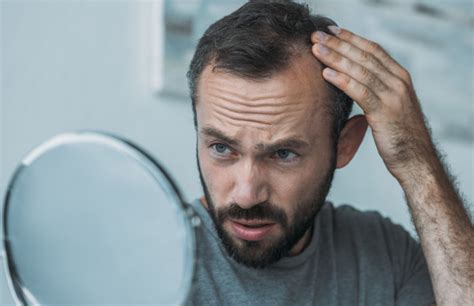 Hair Loss Causes Treatment Options Time News