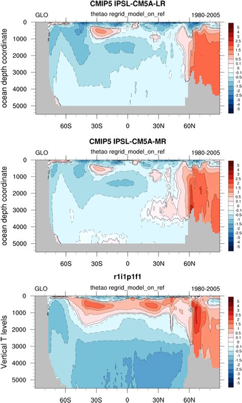 Latitudedepth Distribution Of The Global Zonal Mean Ocean Temperature