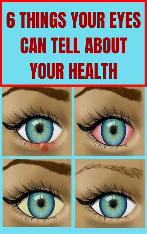 6 things your eyes can tell about your health only tips