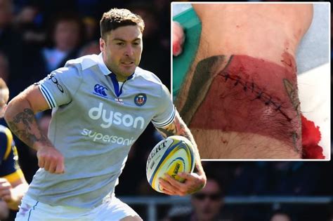 Rugby Player Matt Banahan Slices Wrist Open While Using A Dishwasher In