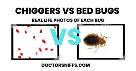 Chiggers In Bed Here S What You Need To Know