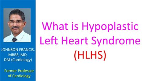 What Is Hypoplastic Left Heart Syndrome Hlhs Youtube