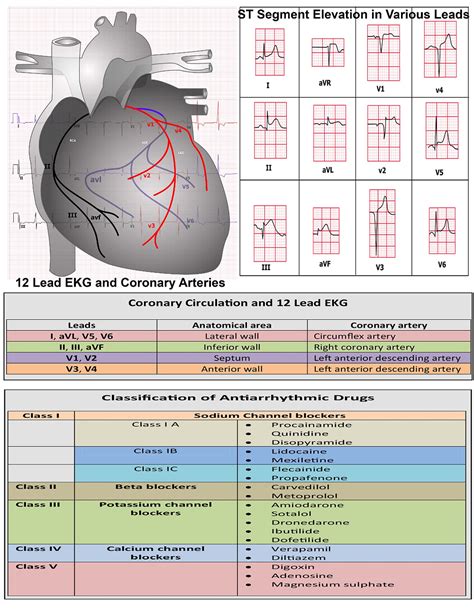 Printable 12 Lead Ekg Interpretation Cheat Sheet