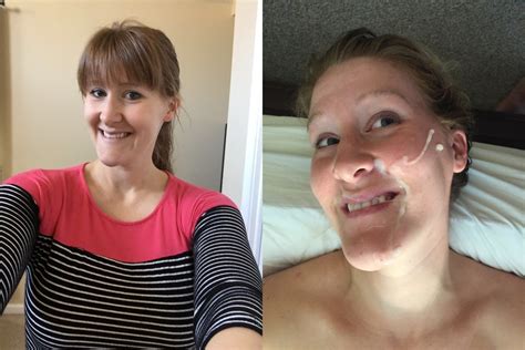 Before And After Facials 21 SickJunk Com
