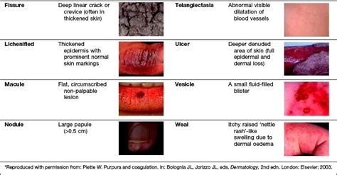 Dermatology Skin Lesion Descriptions Rash