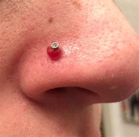 A Comprehensive Guide To Piercing Bumps Ng