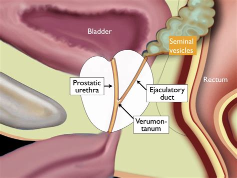 Zonal Anatomy Of Prostate Anatomical Charts And Posters