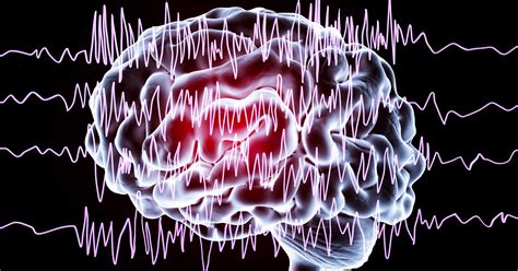 Epilepsie Ursachen And Therapie Ratgeber Nerven