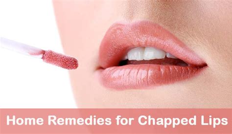 15 Awesome Natural Remedies For Chapped Lips Causes And Prevention