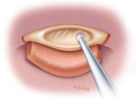 Surgical Anatomy Of The Ear Oto Surgery Atlas