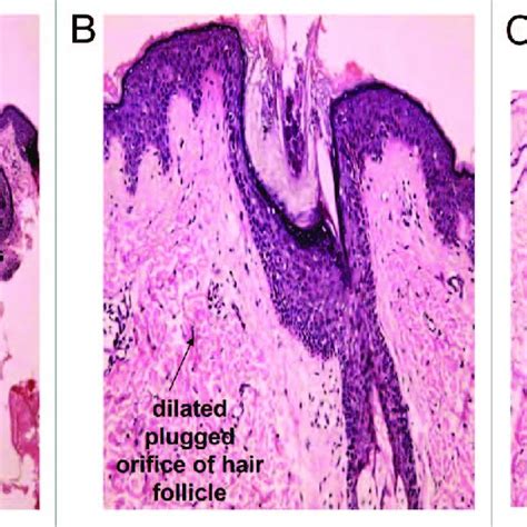 Regulation Of The Biological Function Of Human Sebaceous Gland Cells