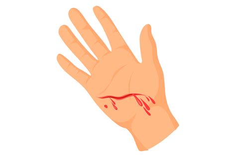 Hand With Bleeding Cut Palm Wound Inju Illustration Par Smartstartstocker Creative Fabrica