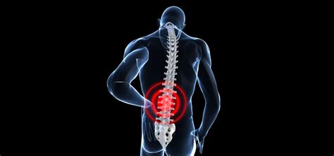 Kinesiology And Sport Review Low Back Pain Causes And Preventions