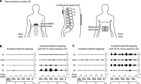 Lower Limb Motor Activity Generated By Transcutaneous Lumbar Scs A