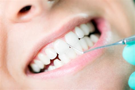 Teeth Cleaning And Polishing In Aligarh Gentle Dental Home