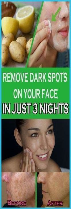 remove dark spots on your face in just 3 nights care for health remove dark spots dark