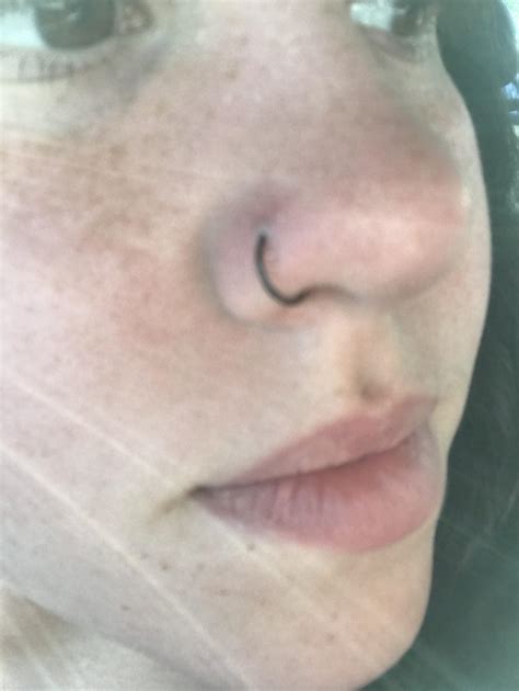 bump on nose piercing possibly from irritation sorry for bad quality it s hard to get a