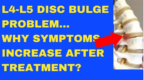 Why Does L4 L5 Disc Bulge Symptom Increase After Treatment Answered