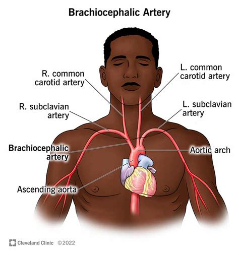 What Is The Brachiocephalic Artery