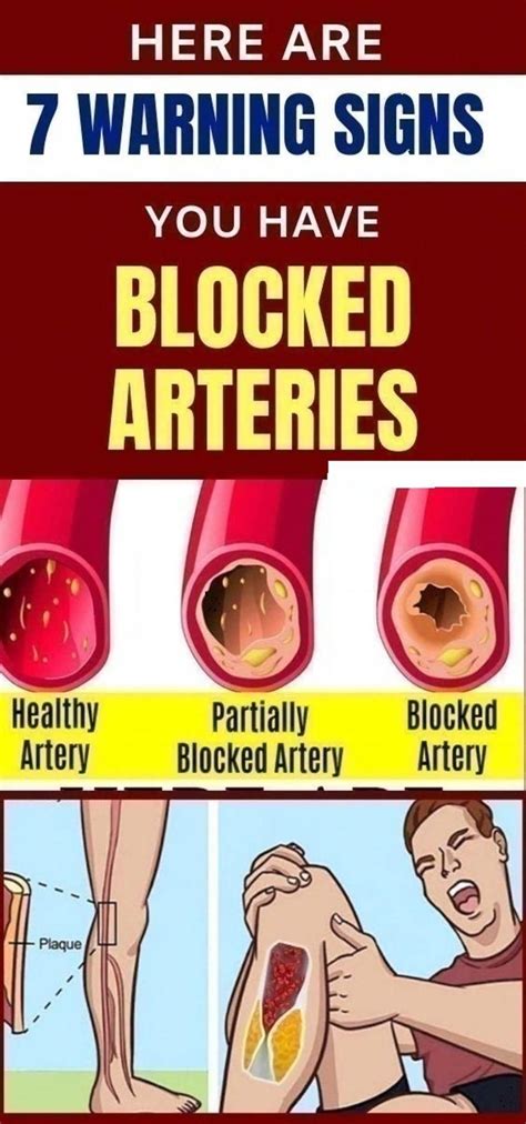 Here Are 7 Warning Signs You Have Blocked Arteries Wellness Magazine