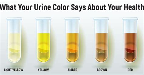 What color urine is bad?