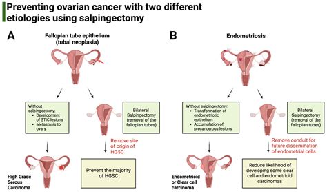Current Oncology Free Full Text Ovarian Cancer From Precursor