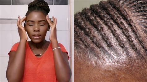 How To Loosen Tight Sore Braids Cornrows In Minutes After Braiding