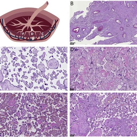Histology Of Normal Villi In The Late Second Trimester Placenta Villi