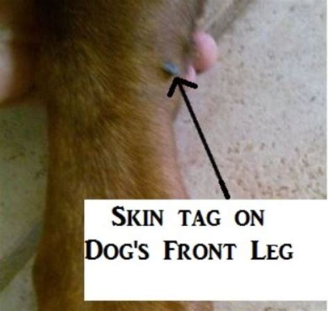 How Do You Remove A Skin Tag From A Dog