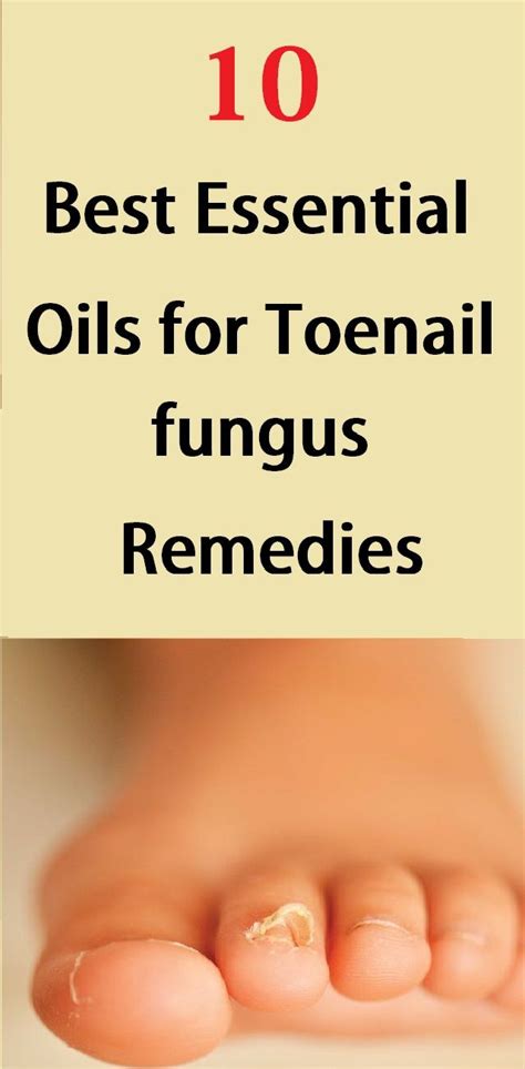 10 Best Essential Oils For Toenail Fungus Remedies Health And Beauty
