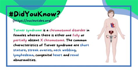 Turner Syndrome Cause Symptoms Diagnosis And Treatment Nucleotides