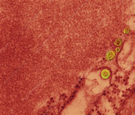 Rabies Virus Particles TEM Stock Image C Science Photo