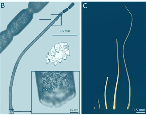 Wow Giant Bacterium Is Largest Ever Discovered