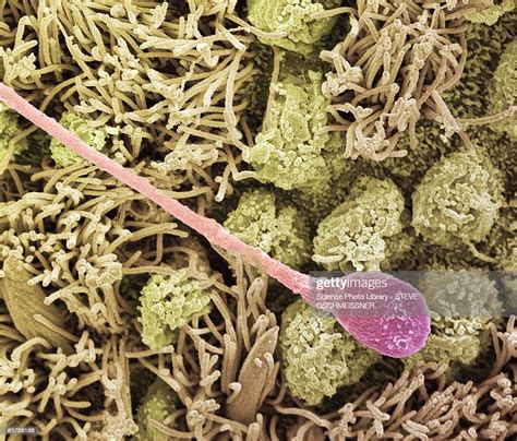 Sperm Cell Scanning Electron Microscope Photo Getty Images
