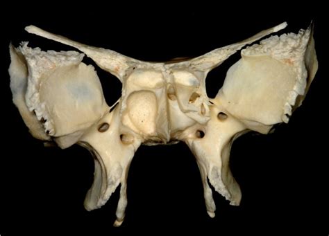 Ventral View Of The Sphenoid Bone Neuroanatomy The Neurosurgical Atlas