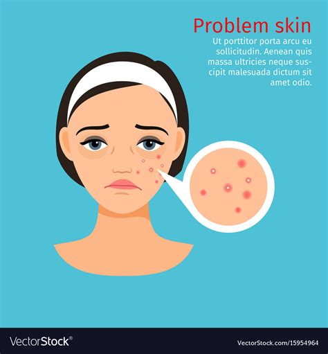 Woman Face Problem Skin With Acne Royalty Free Vector Image