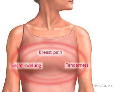 Breast Pain Reasons Your Boobs Feel Sore Tender Heavy Hot Sex Picture