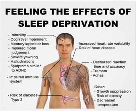 effect of sleep deprivation musely