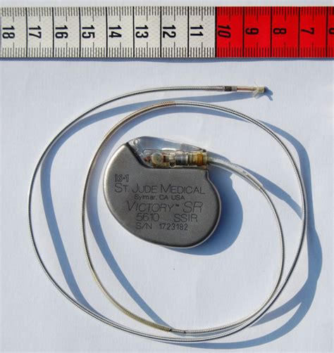 No Battery Required ‘symbiotic Pacemaker Powered By Heartbeats Bt
